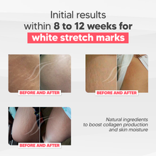 Load image into Gallery viewer, CicatrissimWhite - WHITE Stretch Marks Cream Only - 3 Months Treatment
