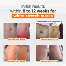 Load image into Gallery viewer, Cicatrissim Stretch Marks Cream - Natural Formula from Brazil - 3 months treatment
